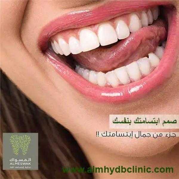 سمات ابتسامة هوليوود